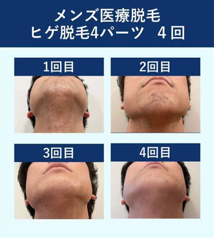 脱毛していない芸能人は誰？うわさの背景と美容の多様性を整理